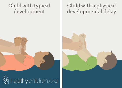 Animated GIF showing the movements of a young child with typical development who can support their head as they sit up, compared with a young child with a physical developmental delay who cannot.